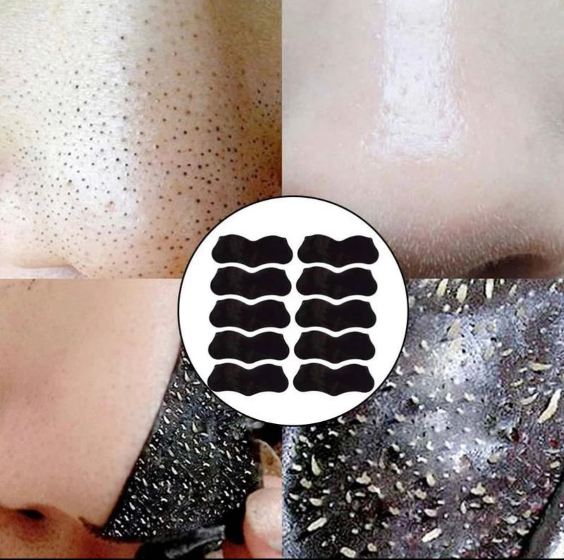 Anti Mitesser Kohle Pads